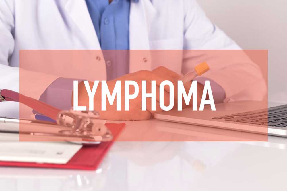 Best Treatment Options for Non Hodgkin Lymphoma