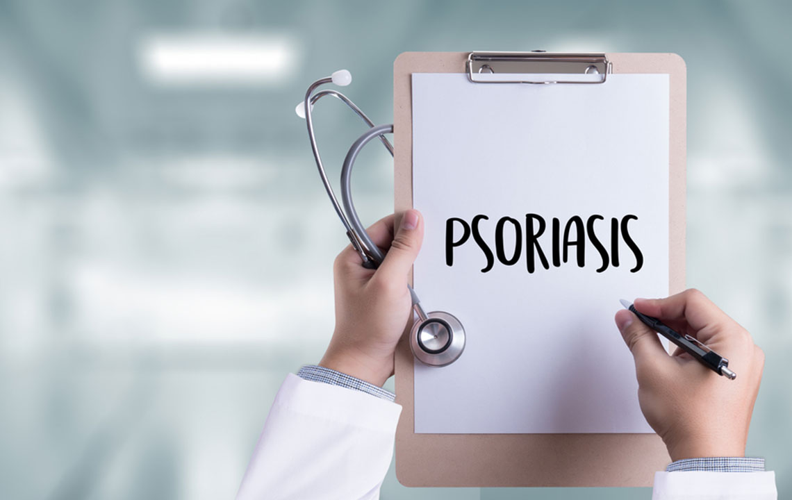 Here are Some Treatment Options for Psoriasis