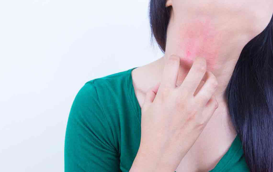 10 over-the-counter treatments for eczema that offer better results