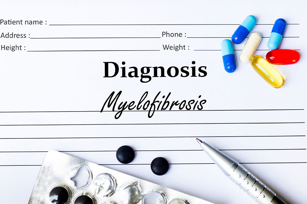 Myelofibrosis &#8211; Symptoms, causes, and management options