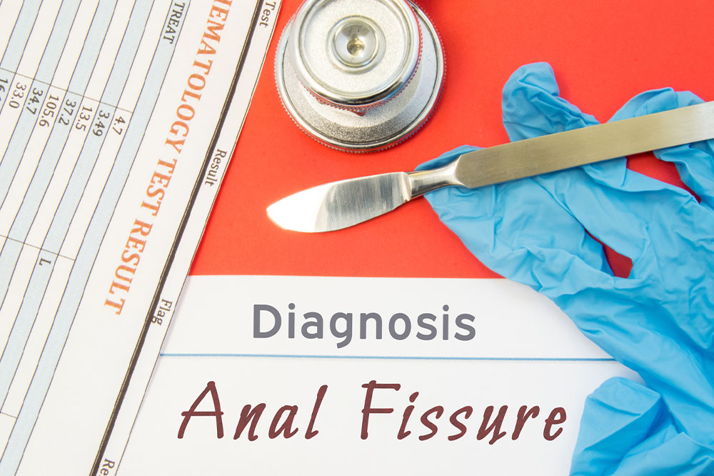 Anal Fissures &#8211; Its Causes, Symptoms, and Management